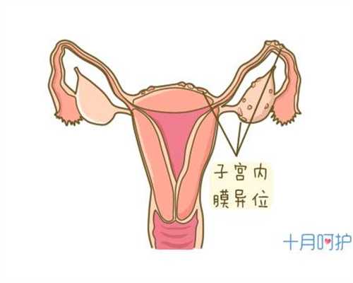 国内代孕哪家便宜:输卵管堵塞的症状如何