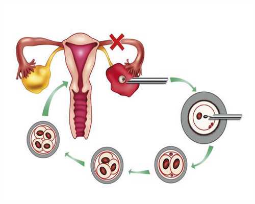 助孕中药一般有几个疗程-先天性卵巢发育不全症