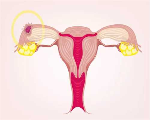 卵巢发育不全治疗需要多久，石女有哪些好的治