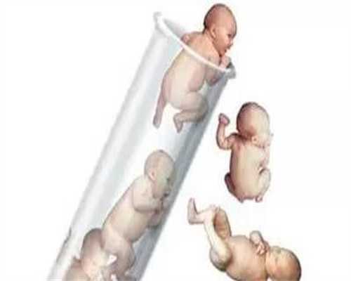 试管婴儿哪里比较专业·孕晚期有助于顺产的方法