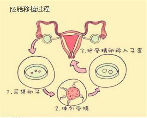 厦门找孕妇代开孕检单怎么办·输卵管妊娠最狭窄部位