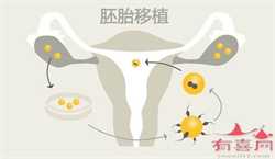合肥供卵助孕步骤,台湾试管婴儿3代流程